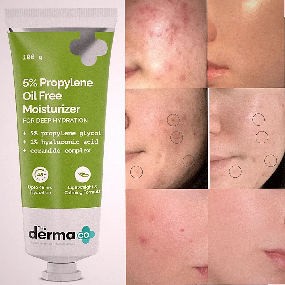 The Derma Co 5% Propylene Oil-Free Moisturizer for deep cleans skin 100 g